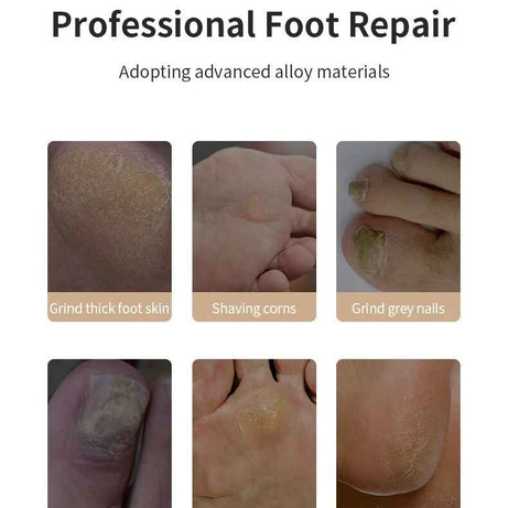 Rechargeable Automatic Foot Grinder Electric | Foot Callus Rubbing Pedicure | Best for Dead Skin Remover