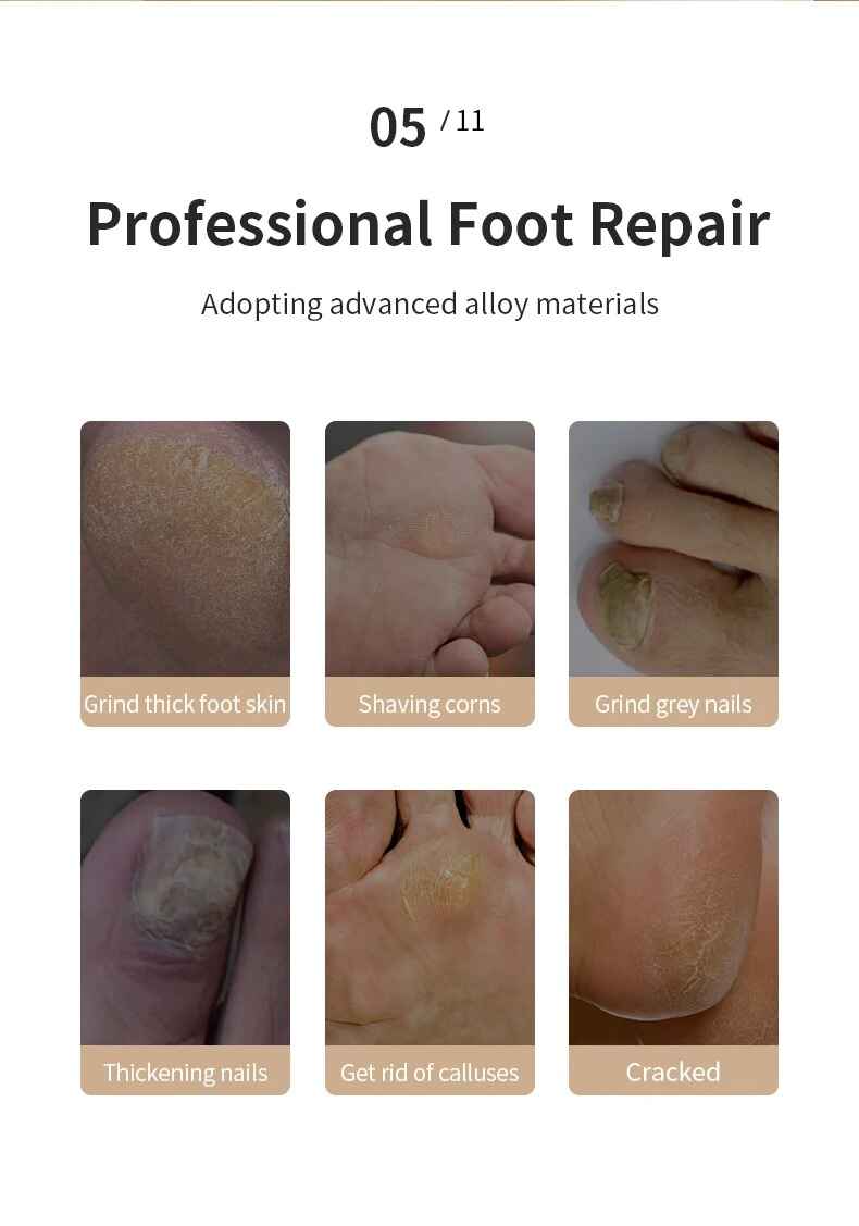 Rechargeable Automatic Foot Grinder Electric | Foot Callus Rubbing Pedicure | Best for Dead Skin Remover