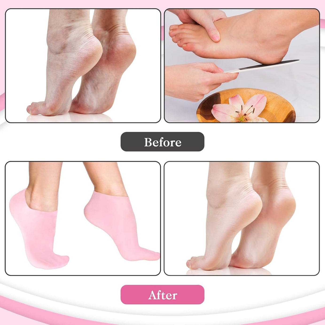 Moisturizing Silicone Socks + Gloves – Spa-Quality Repair & Soft Skin Care