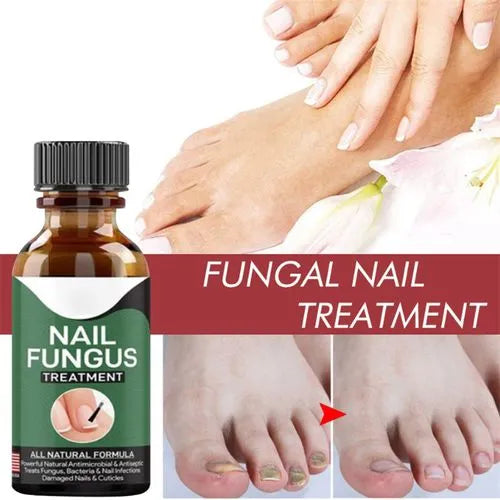 Nail Fungus Treatment Serum