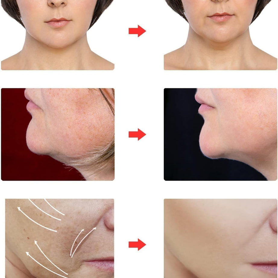 Reusable Facial Belt for reduce Double Chin, V-Shaped Face & Beautiful Jawline (Imported)